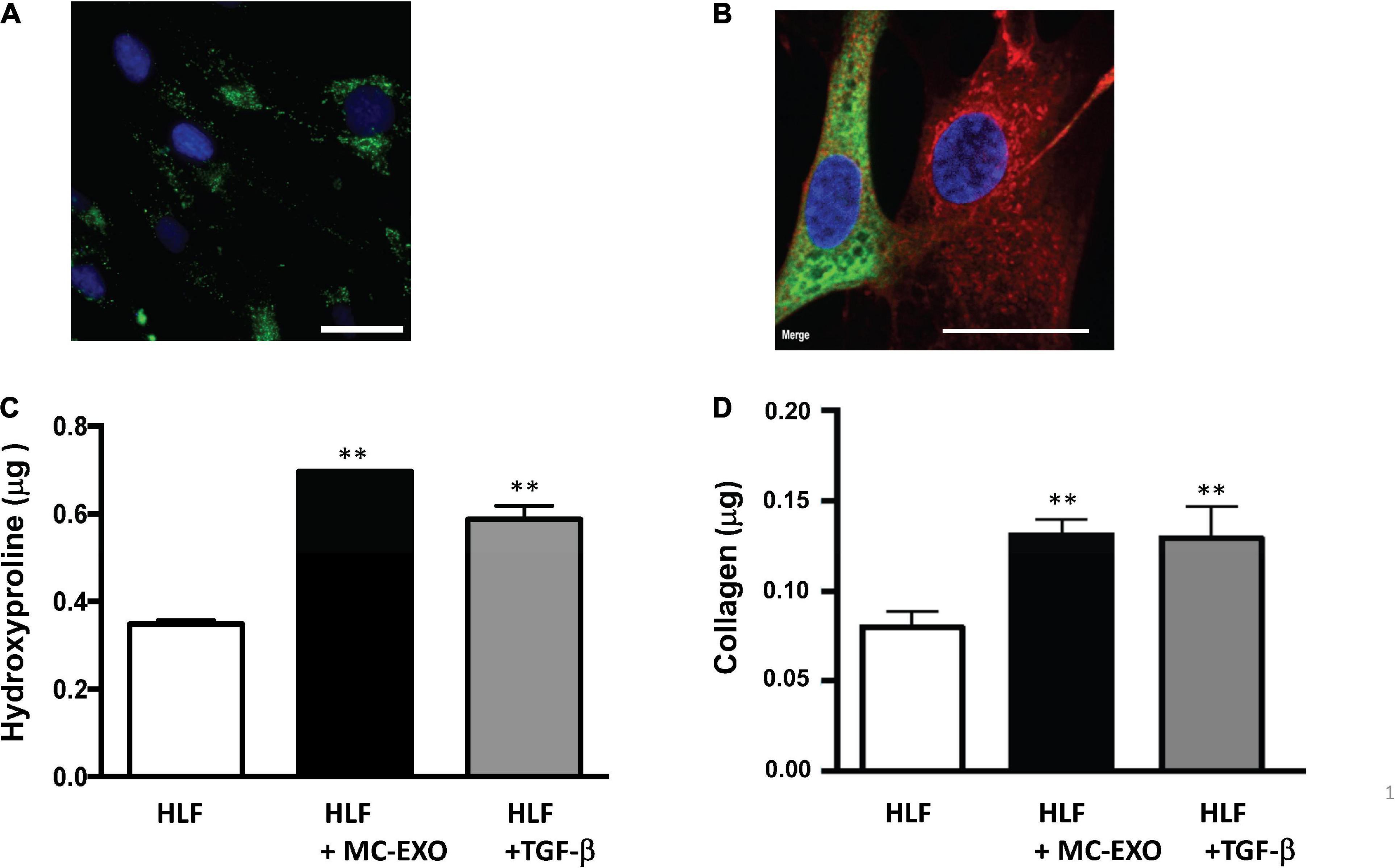 The mast cell exosome-fibroblast connection: A novel pro-fibrotic pathway